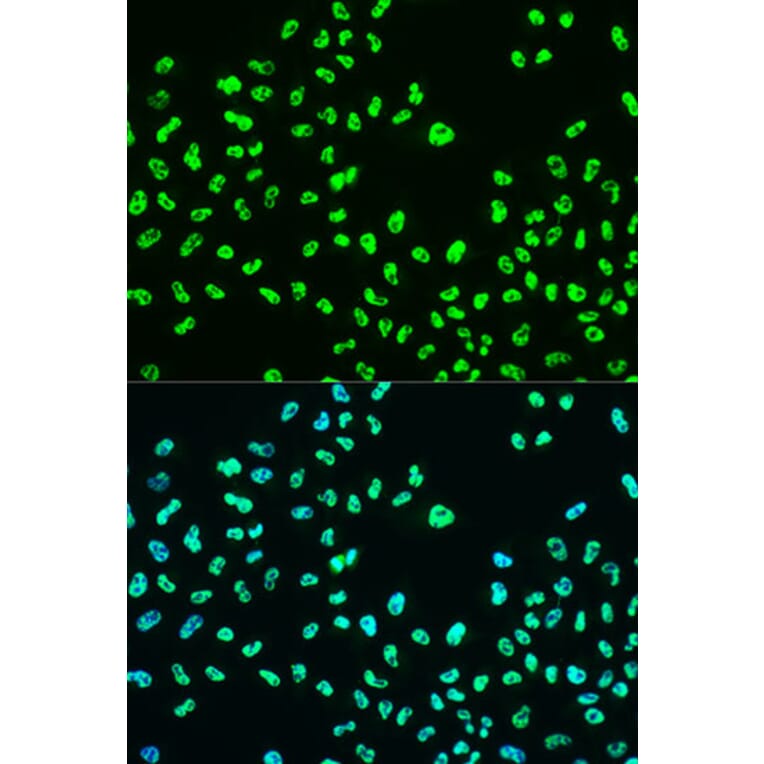 Immunofluorescence - Anti-BRCA1 (phospho Ser988) Antibody (A10925) - Antibodies.com