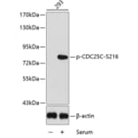 Western Blot - Anti-CDC25C (phospho S216) Antibody (AP0323) - Antibodies.com