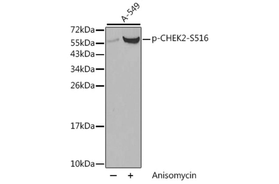 Western Blot - Anti-CHEK2 (phospho S516) Antibody (AP0331) - Antibodies.com