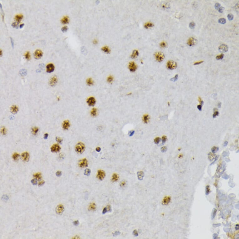 Immunohistochemistry - Anti-CREB (phospho Ser133) Antibody (A10929) - Antibodies.com
