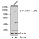 Western Blot - Anti-beta Catenin (phospho Thr41 + Ser45) Antibody (A10930) - Antibodies.com