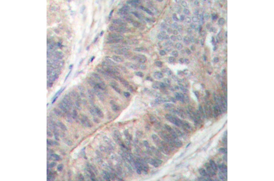 Immunohistochemistry - Anti-EIF2AK2 (phospho T451) Antibody (AP0340) - Antibodies.com