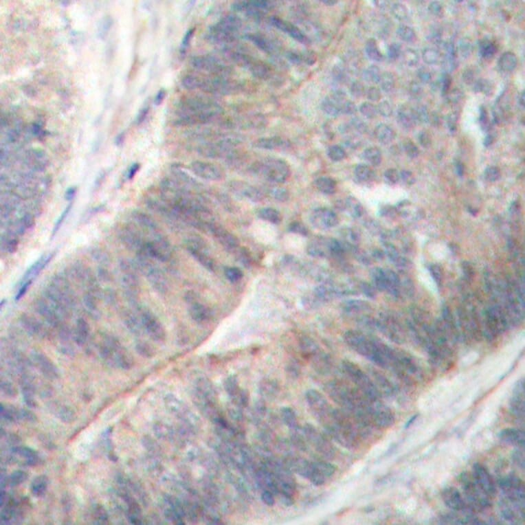 Immunohistochemistry - Anti-EIF2AK2 (phospho T451) Antibody (AP0340) - Antibodies.com