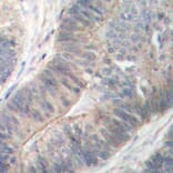 Immunohistochemistry - Anti-EIF2AK2 (phospho T451) Antibody (AP0340) - Antibodies.com