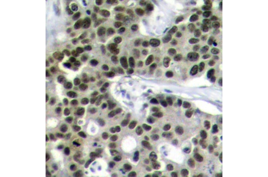 Immunohistochemistry - Anti-HSF1 (phospho S303) Antibody (AP0363) - Antibodies.com