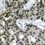 Immunohistochemistry - Anti-HSF1 (phospho S303) Antibody (AP0363) - Antibodies.com