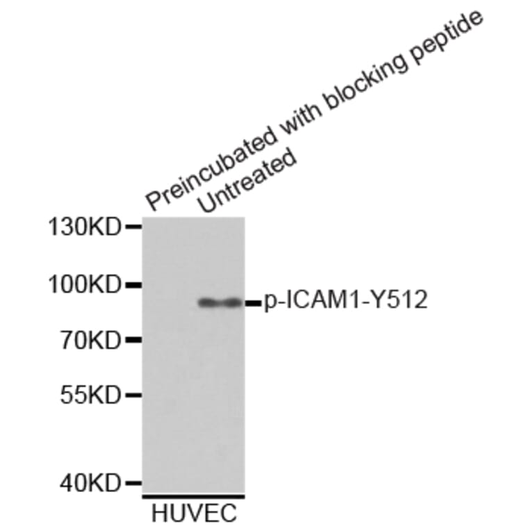 Western Blot - Anti-ICAM1 (phospho Y512) Antibody (AP0365) - Antibodies.com