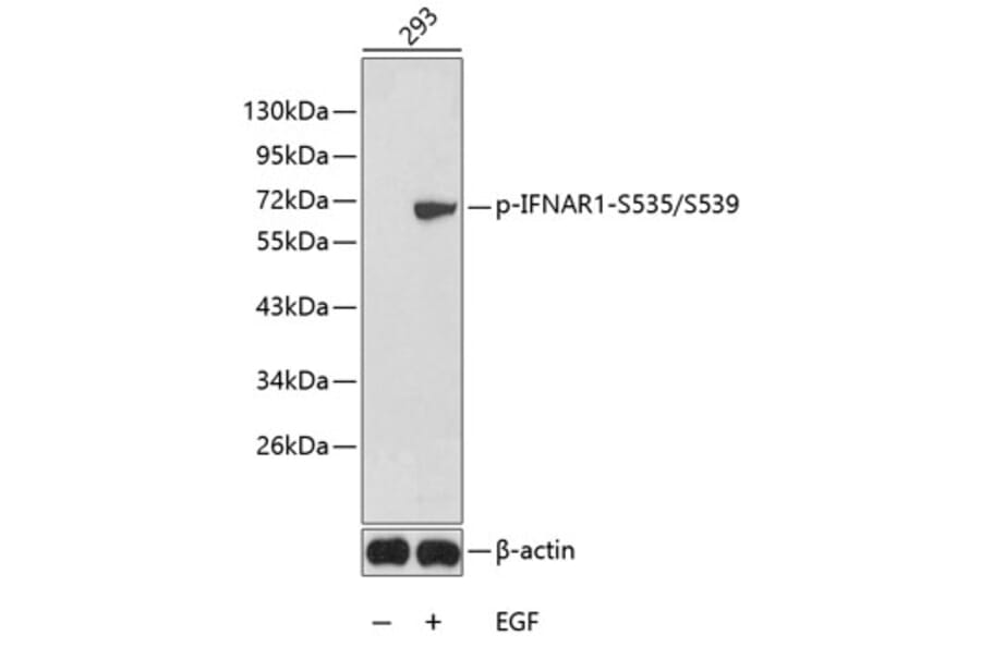 Western Blot - Anti-IFNAR1 (phospho S535 + S539) Antibody (AP0366) - Antibodies.com