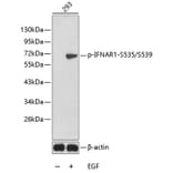 Western Blot - Anti-IFNAR1 (phospho S535 + S539) Antibody (AP0366) - Antibodies.com