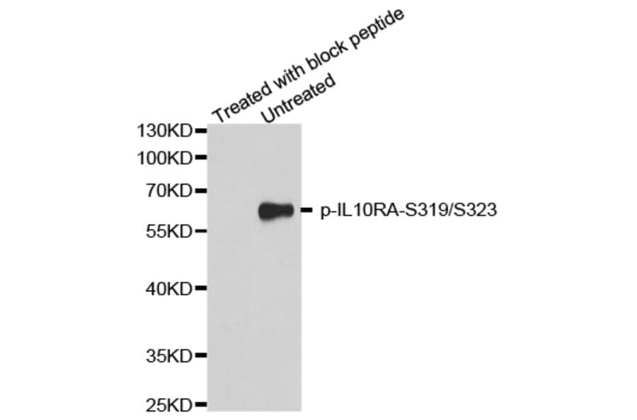 Western Blot - Anti-IL10RA (phospho S319 + S323) Antibody (AP0370) - Antibodies.com