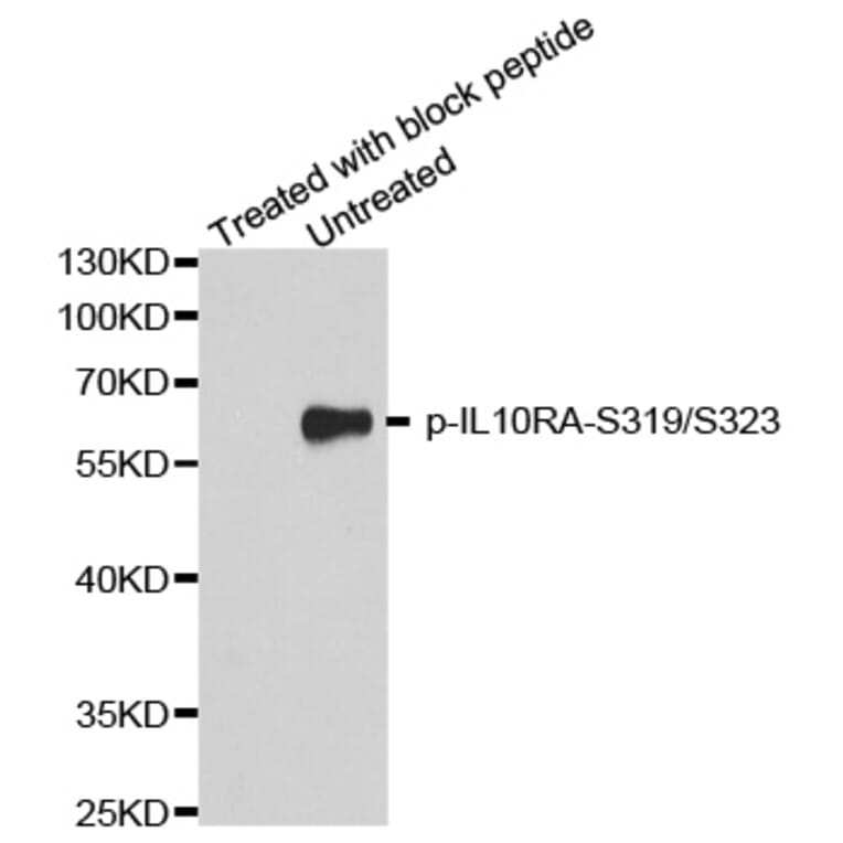 Western Blot - Anti-IL10RA (phospho S319 + S323) Antibody (AP0370) - Antibodies.com