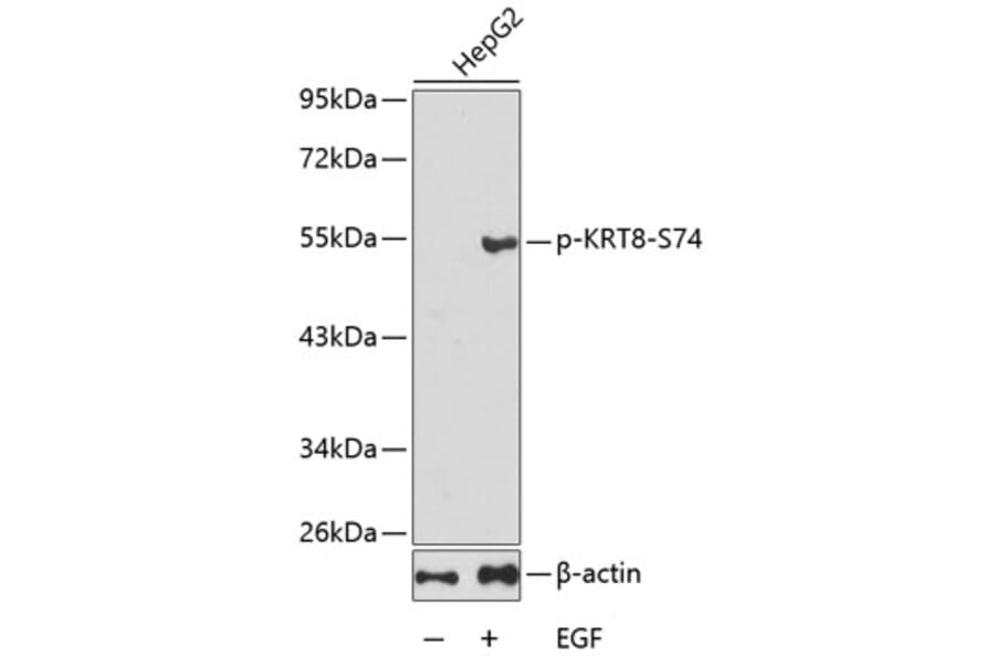Western Blot - Anti-KRT8 (phospho S74) Antibody (AP0386) - Antibodies.com