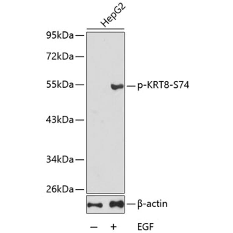 Western Blot - Anti-KRT8 (phospho S74) Antibody (AP0386) - Antibodies.com