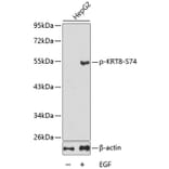Western Blot - Anti-KRT8 (phospho S74) Antibody (AP0386) - Antibodies.com