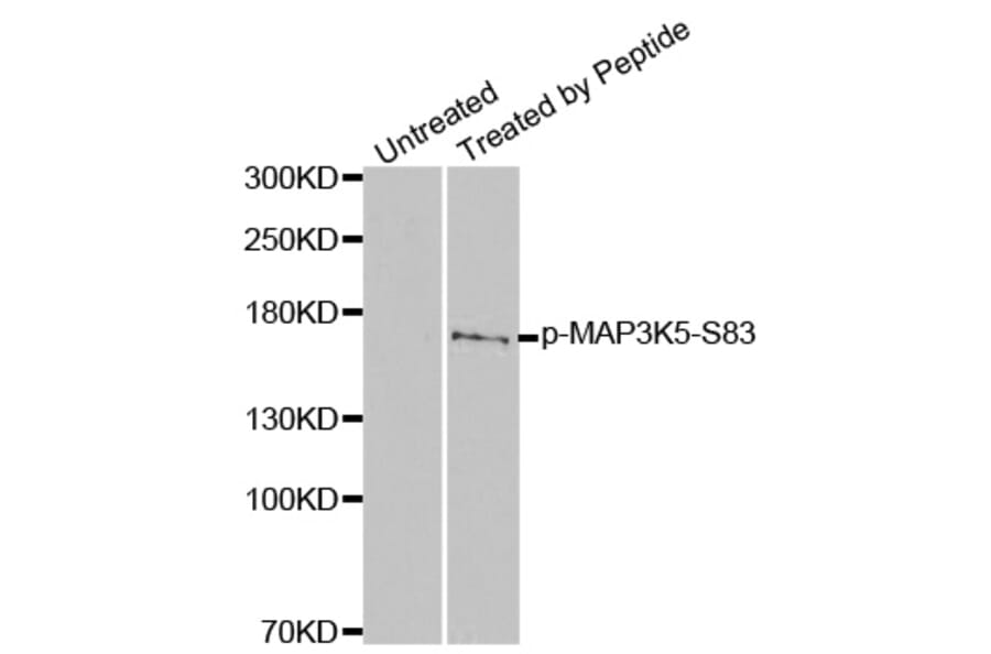 Western Blot - Anti-MAP3K5 (phospho S83) Antibody (AP0394) - Antibodies.com