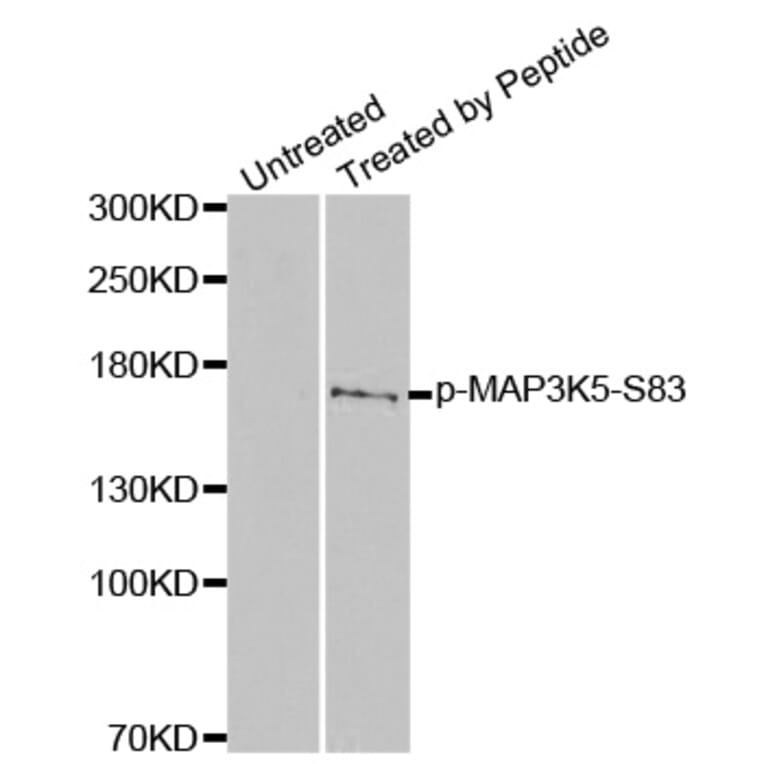 Western Blot - Anti-MAP3K5 (phospho S83) Antibody (AP0394) - Antibodies.com