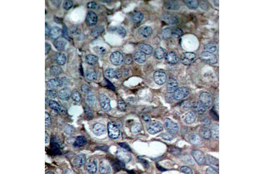 Immunohistochemistry - Anti-MAP3K5 (phospho S83) Antibody (AP0394) - Antibodies.com