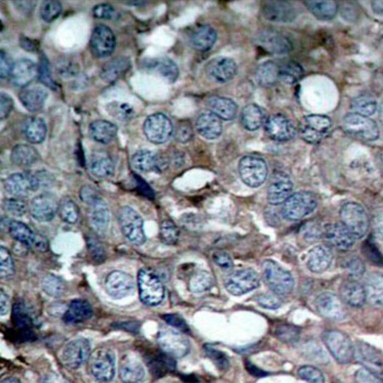 Immunohistochemistry - Anti-MAP3K5 (phospho S83) Antibody (AP0394) - Antibodies.com