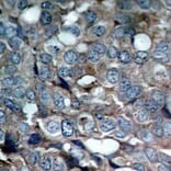 Immunohistochemistry - Anti-MAP3K5 (phospho S83) Antibody (AP0394) - Antibodies.com