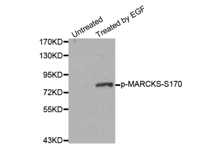 Western Blot - Anti-MARCKS (phospho S170) Antibody (AP0404) - Antibodies.com