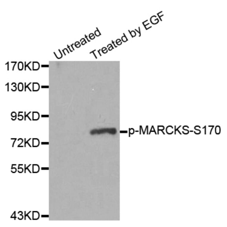 Western Blot - Anti-MARCKS (phospho S170) Antibody (AP0404) - Antibodies.com