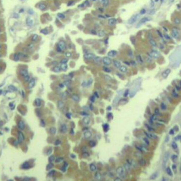 Immunohistochemistry - Anti-MARCKS (phospho S170) Antibody (AP0404) - Antibodies.com