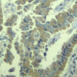 Immunohistochemistry - Anti-MARCKS (phospho S170) Antibody (AP0404) - Antibodies.com