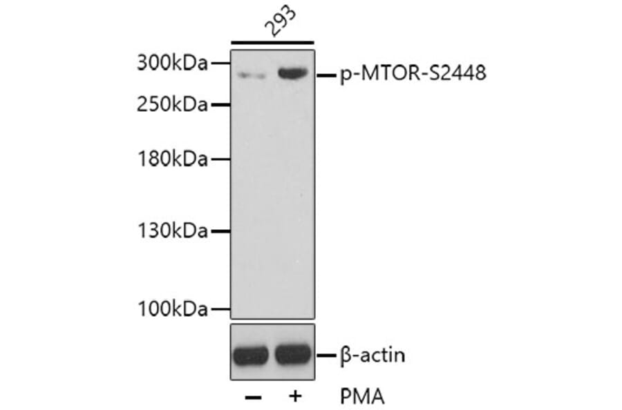 Western Blot - Anti-mTOR (phospho S2448) Antibody (AP0409) - Antibodies.com