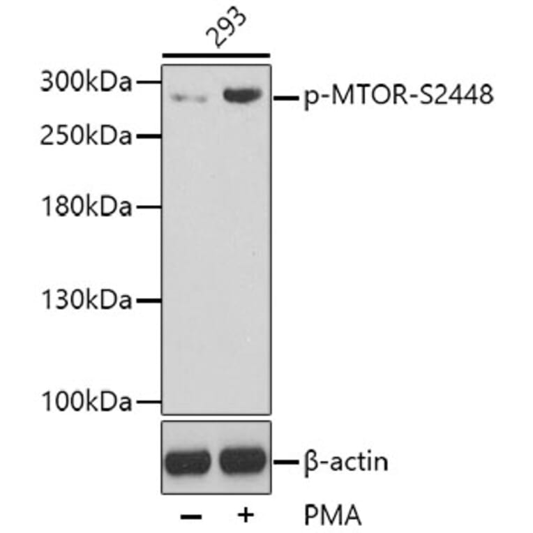 Western Blot - Anti-mTOR (phospho S2448) Antibody (AP0409) - Antibodies.com