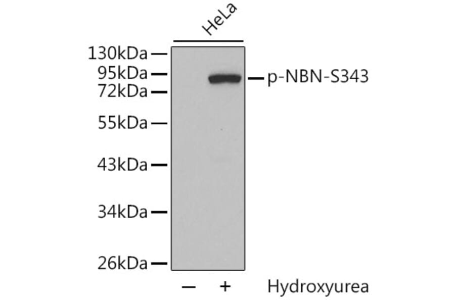 Western Blot - Anti-NBN (phospho S343) Antibody (AP0413) - Antibodies.com