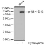 Western Blot - Anti-NBN (phospho S343) Antibody (AP0413) - Antibodies.com