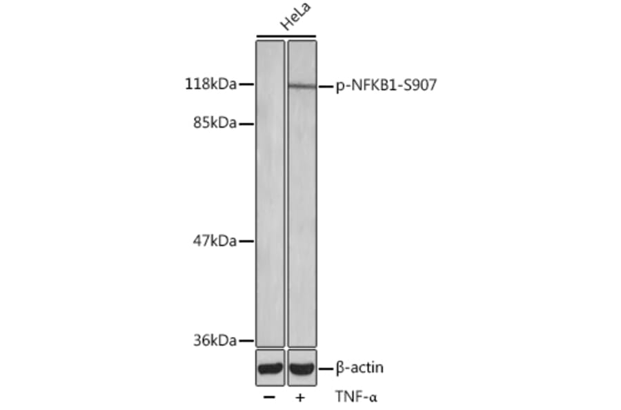 Western Blot - Anti-NFkB p105/p50 (phospho Ser907) Antibody (A10946) - Antibodies.com