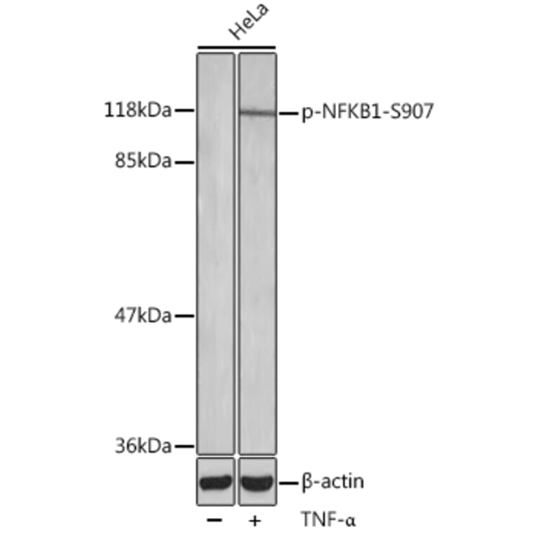 Western Blot - Anti-NFkB p105 / p50 (phospho Ser907) Antibody (A10946) - Antibodies.com