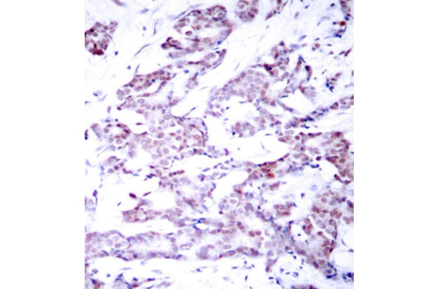 Immunohistochemistry - Anti-STAT6 (phospho T645) Antibody (AP0455) - Antibodies.com