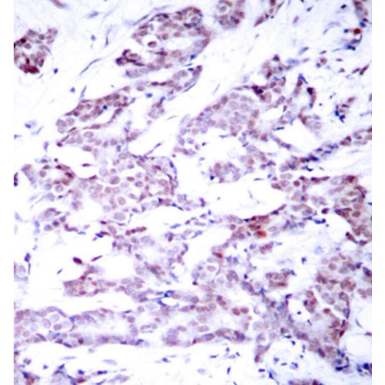 Immunohistochemistry - Anti-STAT6 (phospho T645) Antibody (AP0455) - Antibodies.com