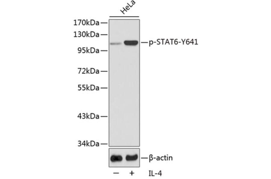 Western Blot - Anti-STAT6 (phospho Tyr641) Antibody (A10952) - Antibodies.com