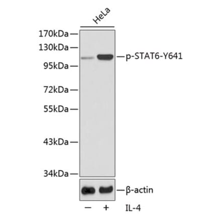 Western Blot - Anti-STAT6 (phospho Tyr641) Antibody (A10952) - Antibodies.com