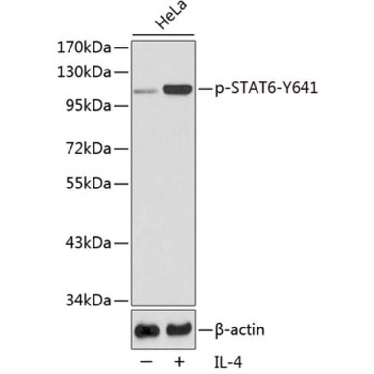 Western Blot - Anti-STAT6 (phospho Tyr641) Antibody (A10952) - Antibodies.com