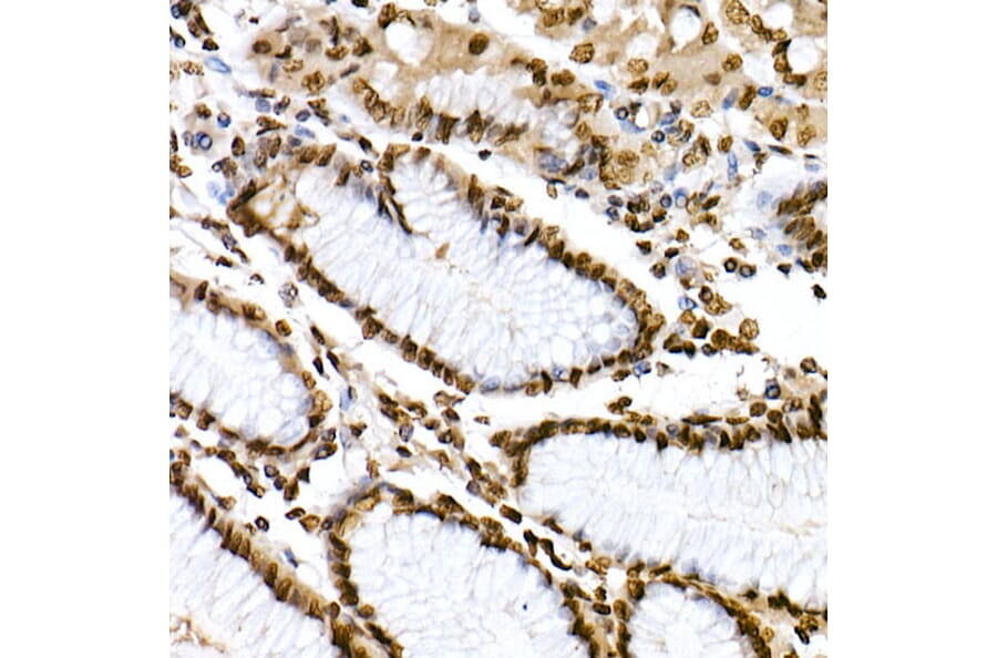Immunohistochemistry - Anti-STAT6 (phospho Tyr641) Antibody (A10952) - Antibodies.com