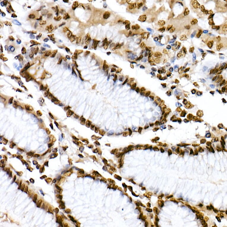 Immunohistochemistry - Anti-STAT6 (phospho Tyr641) Antibody (A10952) - Antibodies.com