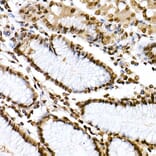 Immunohistochemistry - Anti-STAT6 (phospho Tyr641) Antibody (A10952) - Antibodies.com