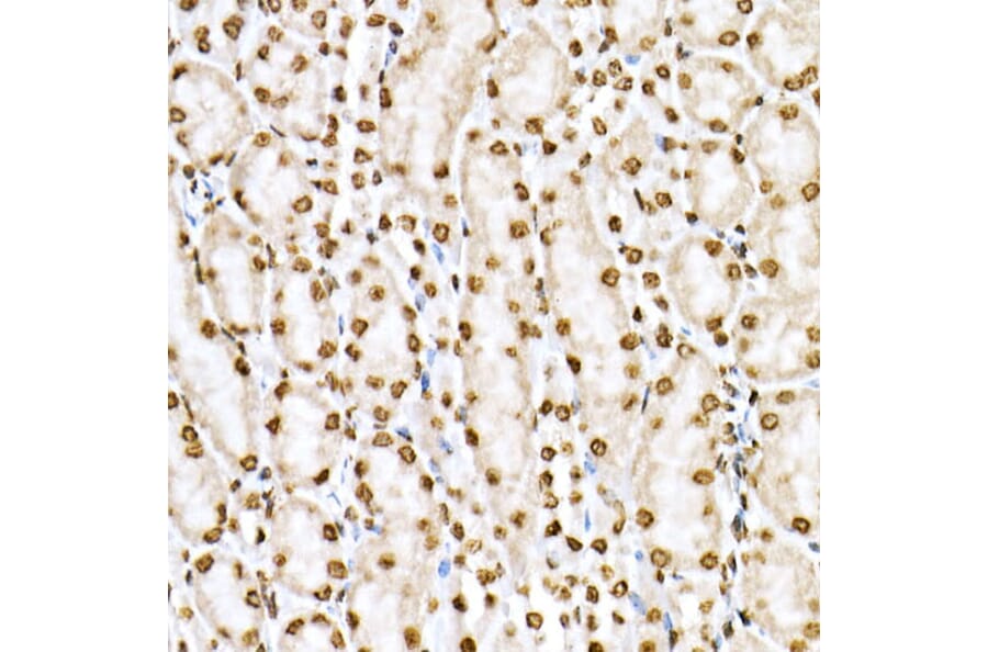 Immunohistochemistry - Anti-STAT6 (phospho Tyr641) Antibody (A10952) - Antibodies.com