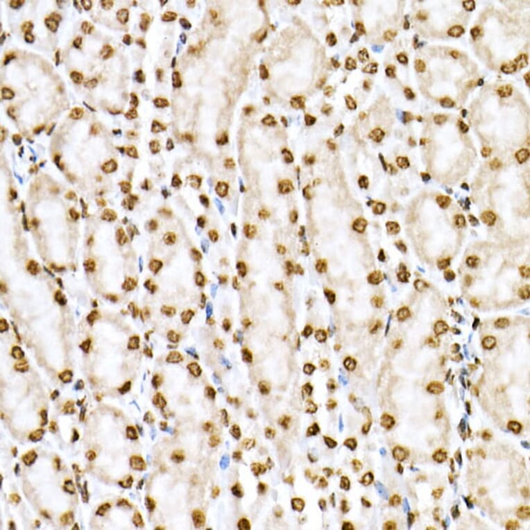 Immunohistochemistry - Anti-STAT6 (phospho Tyr641) Antibody (A10952) - Antibodies.com