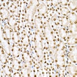 Immunohistochemistry - Anti-STAT6 (phospho Tyr641) Antibody (A10952) - Antibodies.com