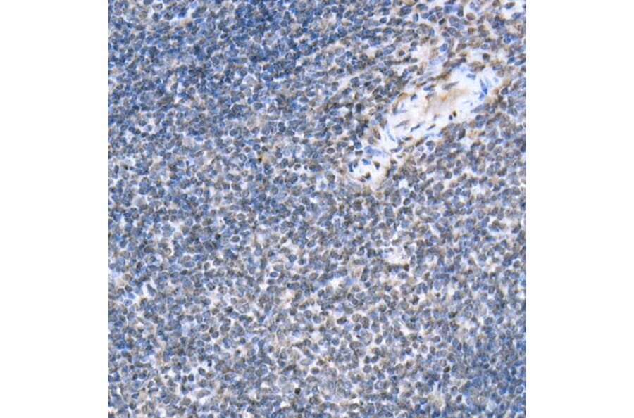 Immunohistochemistry - Anti-STAT6 (phospho Tyr641) Antibody (A10952) - Antibodies.com