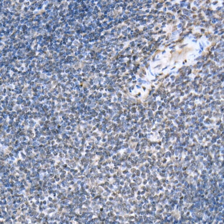 Immunohistochemistry - Anti-STAT6 (phospho Tyr641) Antibody (A10952) - Antibodies.com