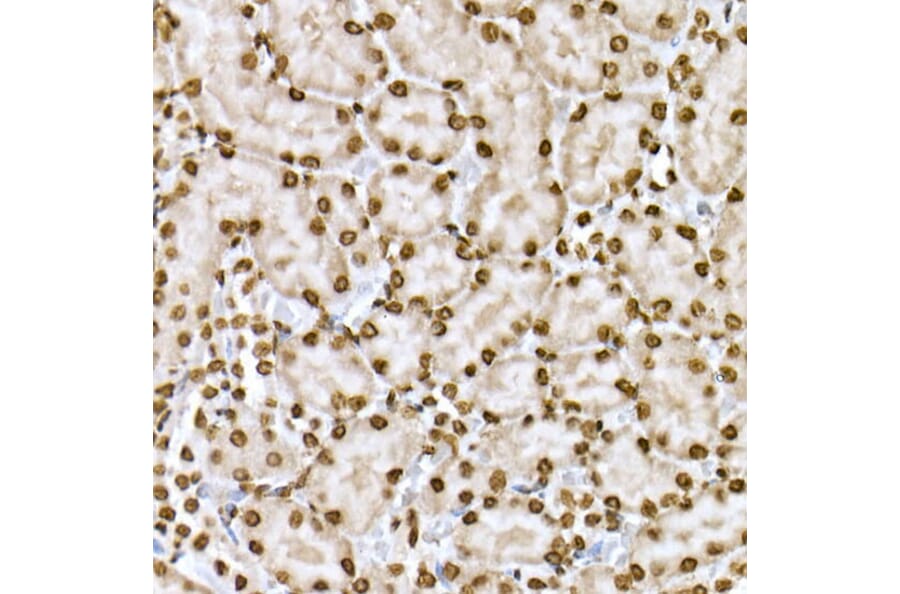 Immunohistochemistry - Anti-STAT6 (phospho Tyr641) Antibody (A10952) - Antibodies.com
