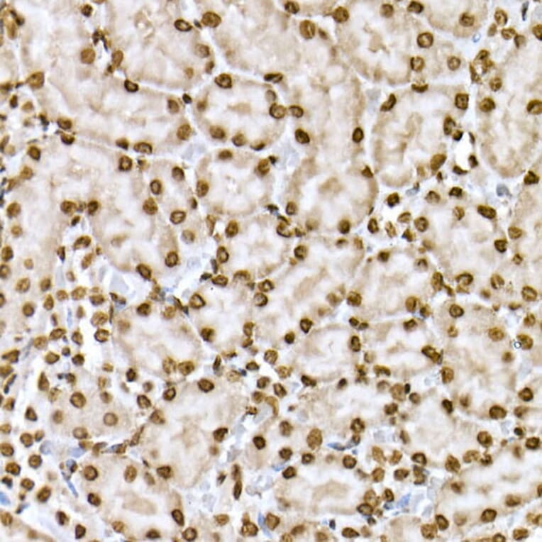 Immunohistochemistry - Anti-STAT6 (phospho Tyr641) Antibody (A10952) - Antibodies.com