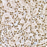 Immunohistochemistry - Anti-STAT6 (phospho Tyr641) Antibody (A10952) - Antibodies.com