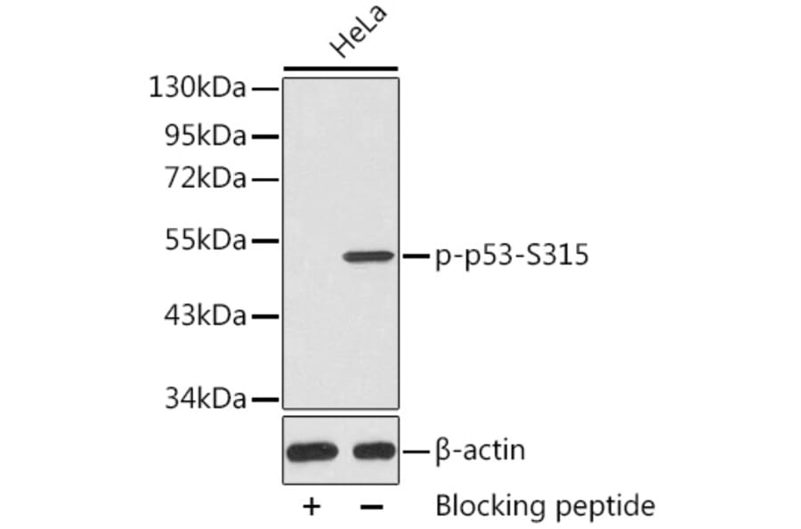 Western Blot - Anti-p53 (phospho Ser315) Antibody (A10954) - Antibodies.com